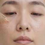 Glycolic Acid vs. Lactic Acid: Which AHA Erases Dark Spots and Refines Texture Best?